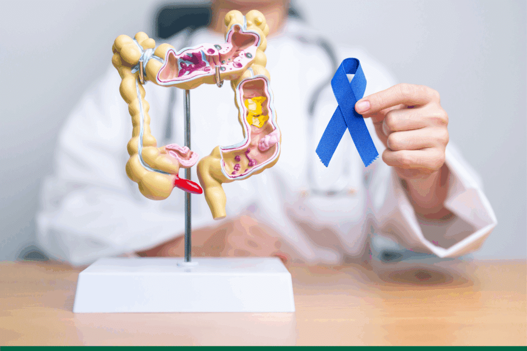 Cancer du colon : le dépistage permet de guérir 9 cas sur 10