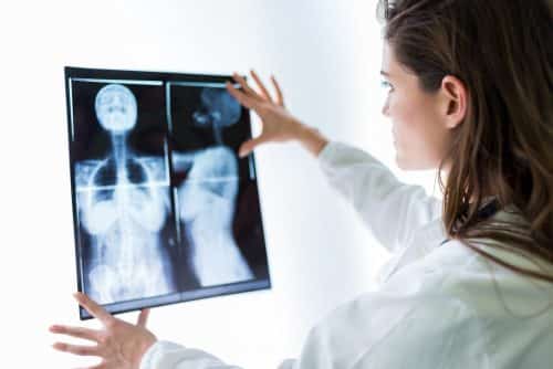 Cancer du sein : quand se faire dépister ?