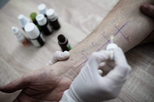 Autres pathologies